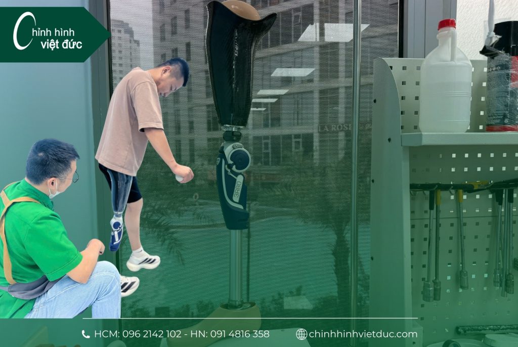 Tập đi chân giả trên gối khớp 3R80 cùng anh khách Hưng Yên