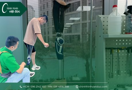 tập đi chân giả trên gối