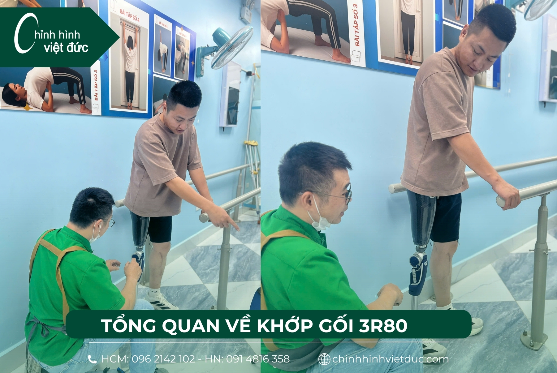 tập đi chân giả trên gối khớp 3r80