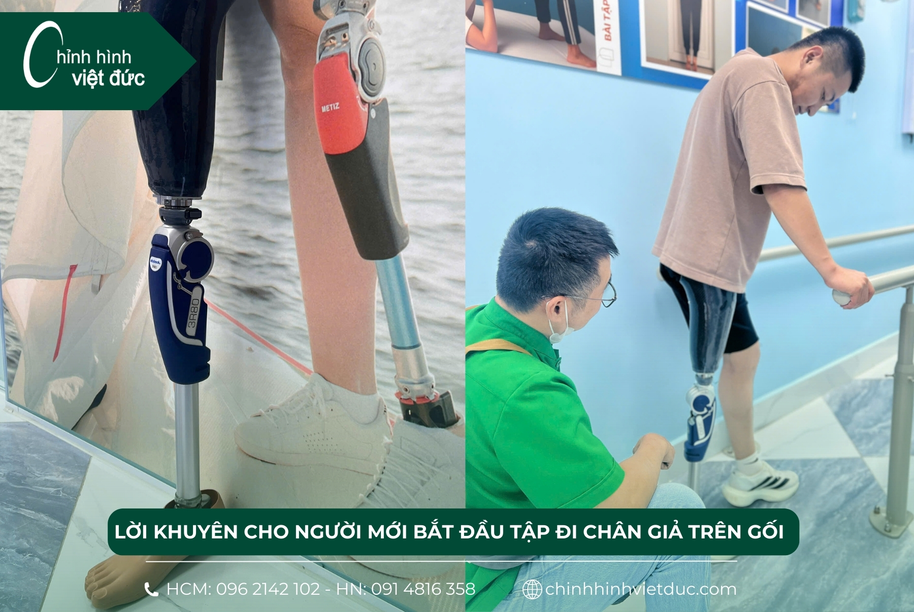 tập đi chân giả trên gối 