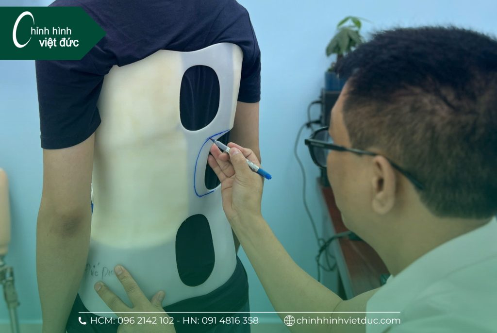 Ưu điểm của áo nẹp chỉnh hình cột sống