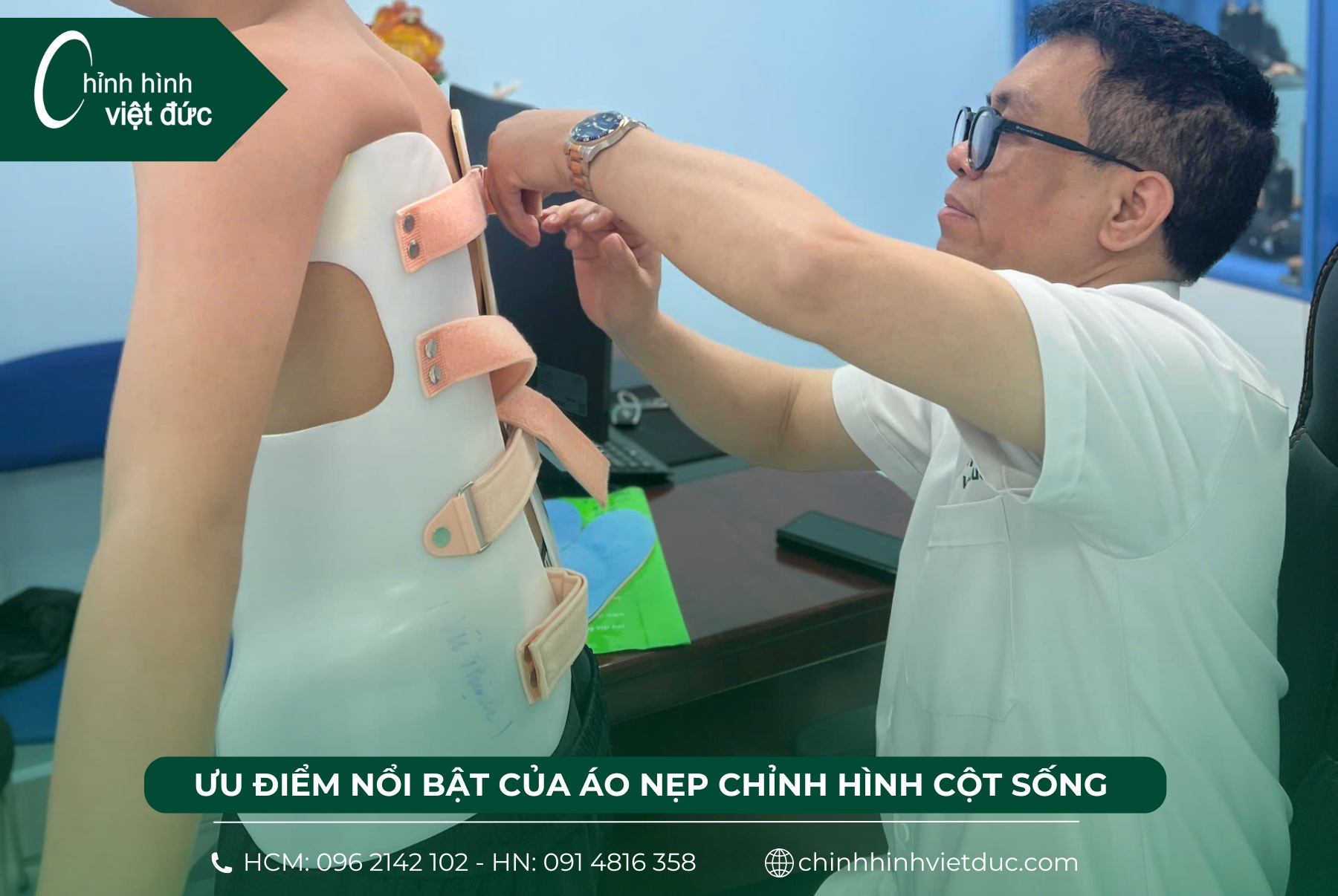ưu điểm của nẹp chỉnh hình