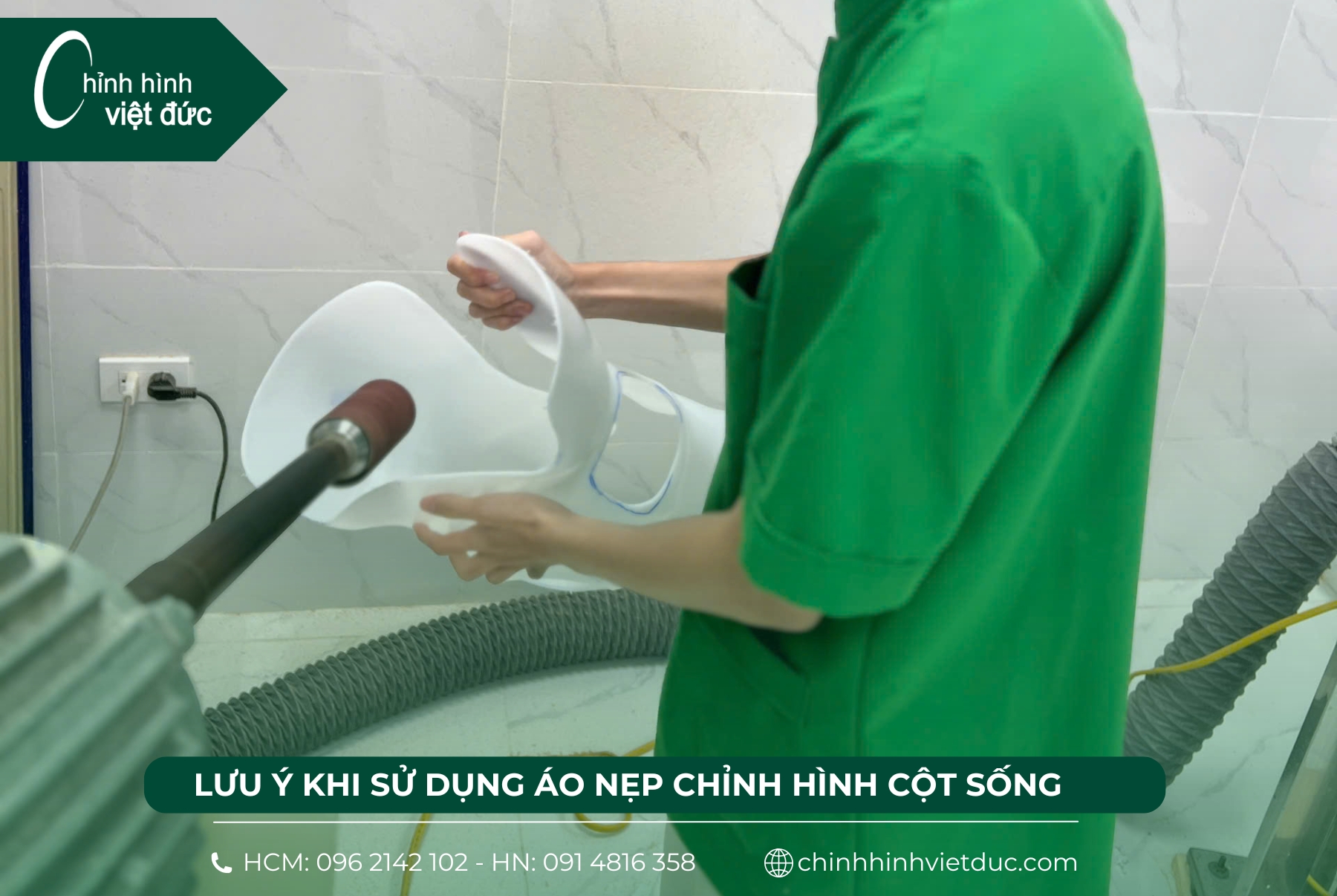 ưu điểm của nẹp chỉnh hình