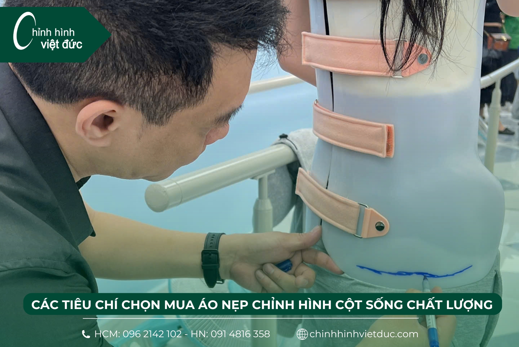 ưu điểm của nẹp chỉnh hình