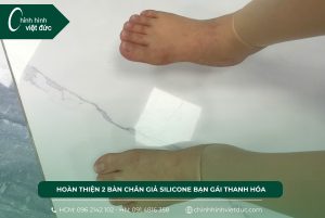Hoàn thiện 2 bàn chân giả silicone bạn gái Thanh Hóa