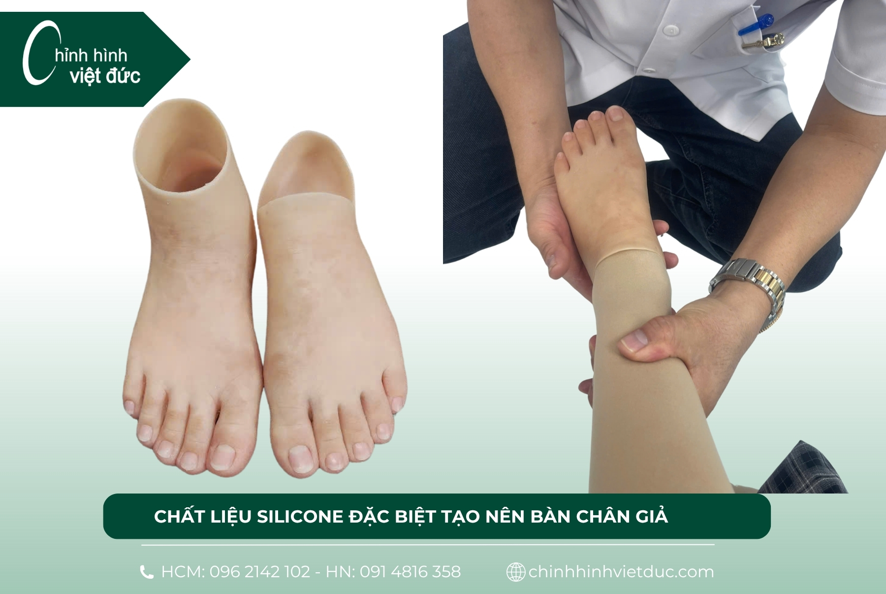 bàn chân giả Silicone