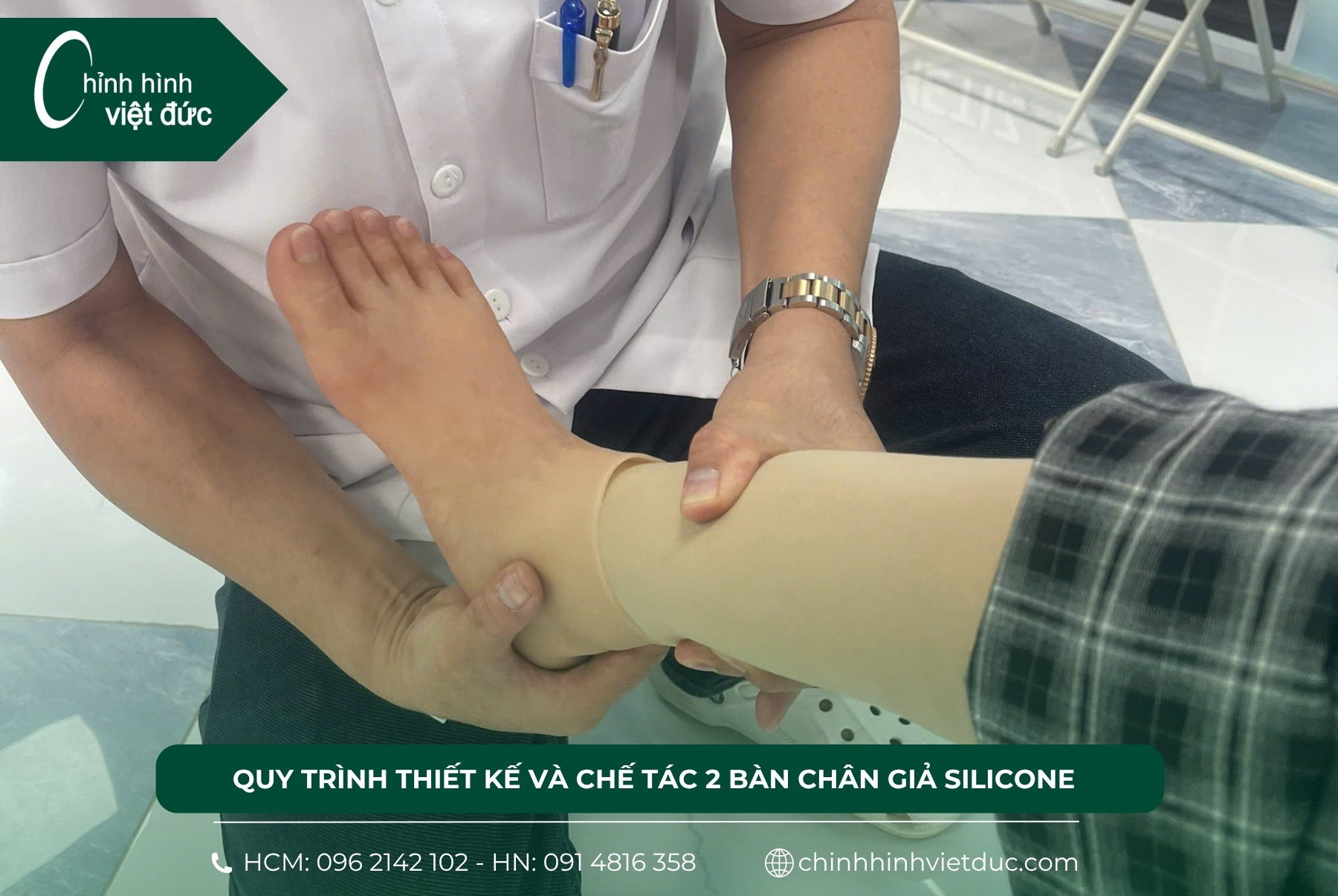 bàn chân giả Silicone