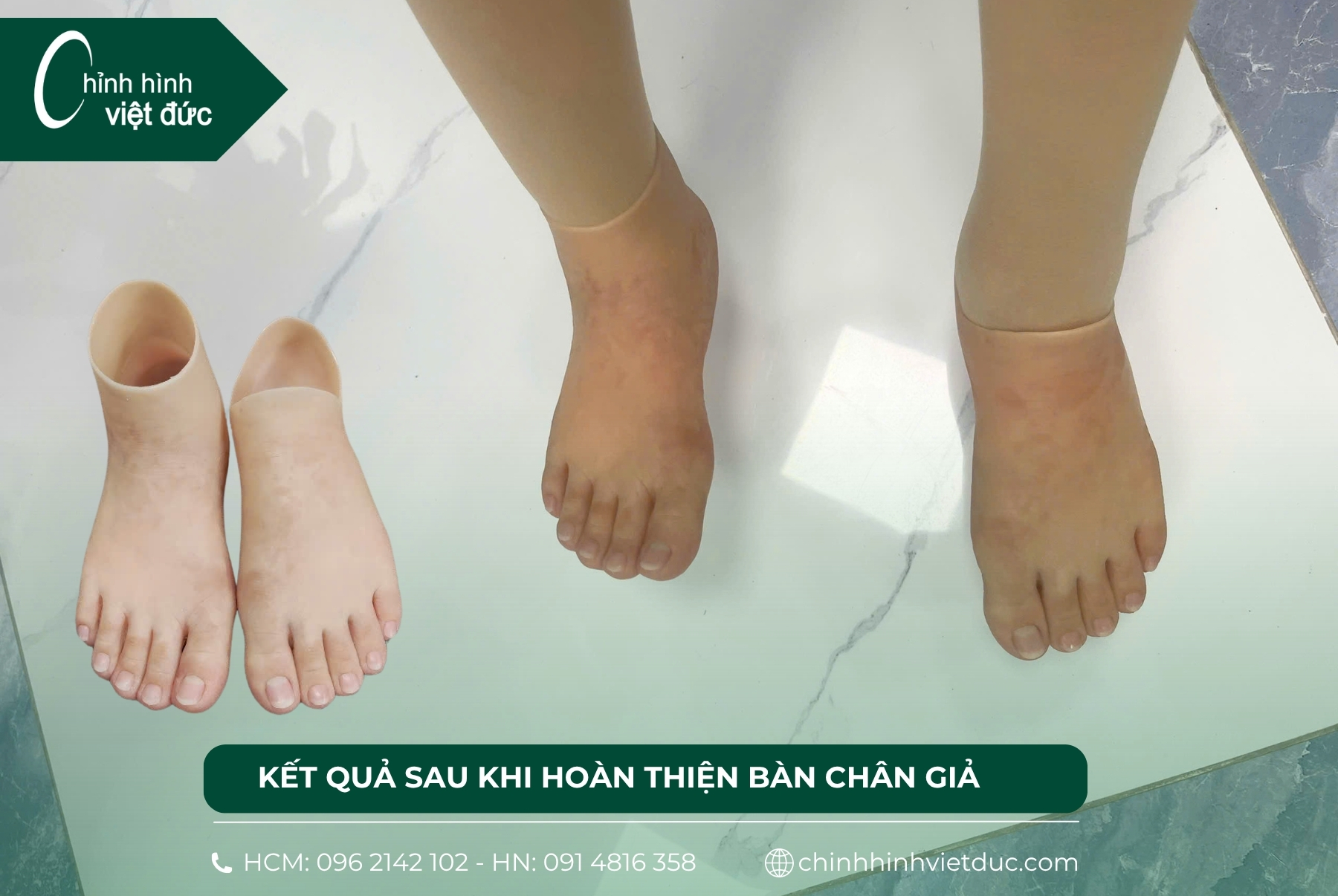 bàn chân giả Silicone