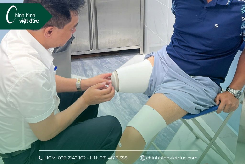 Mất 2 chân làm chân giả có đi được không?