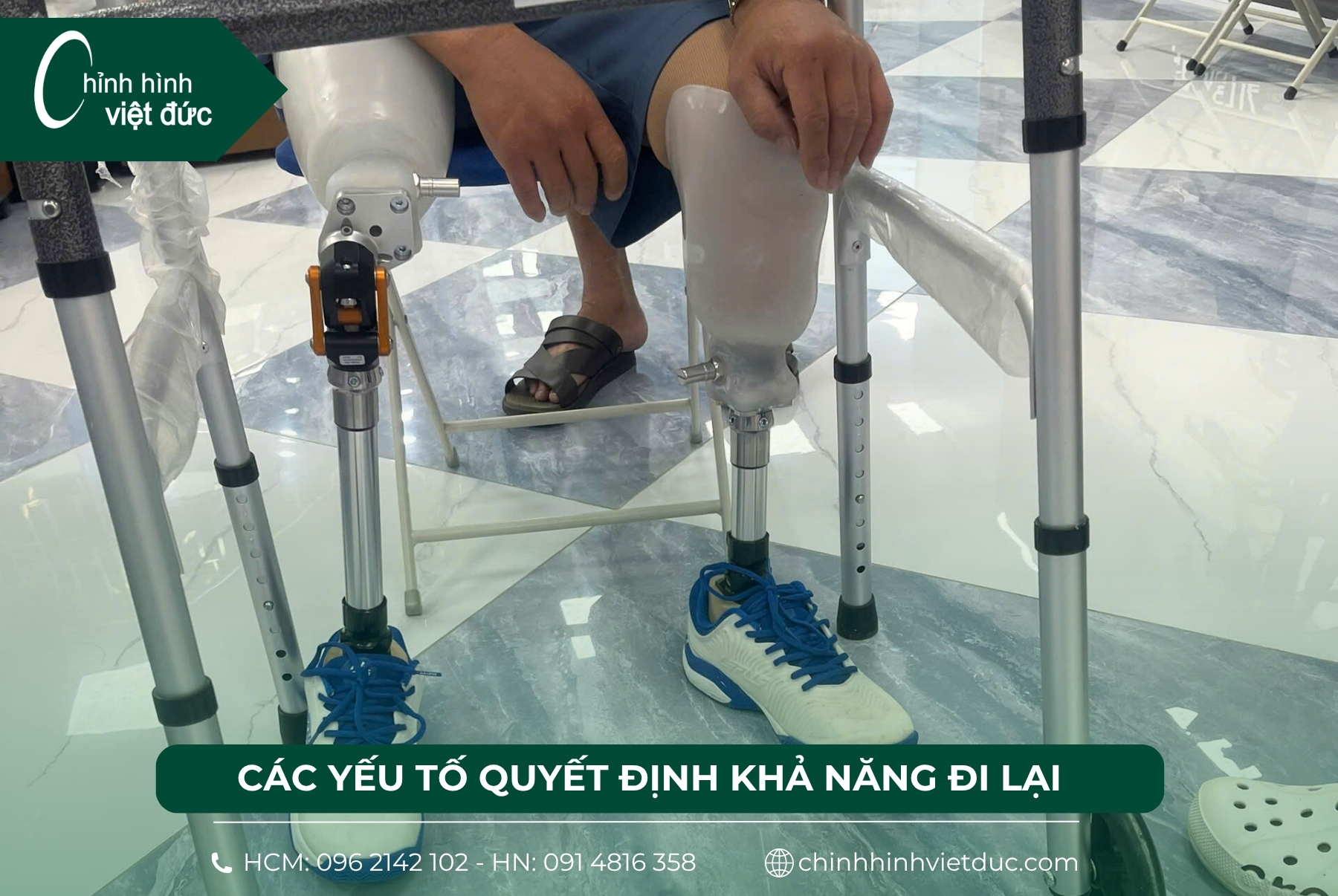 Mất 2 chân làm chân giả có đi được không?