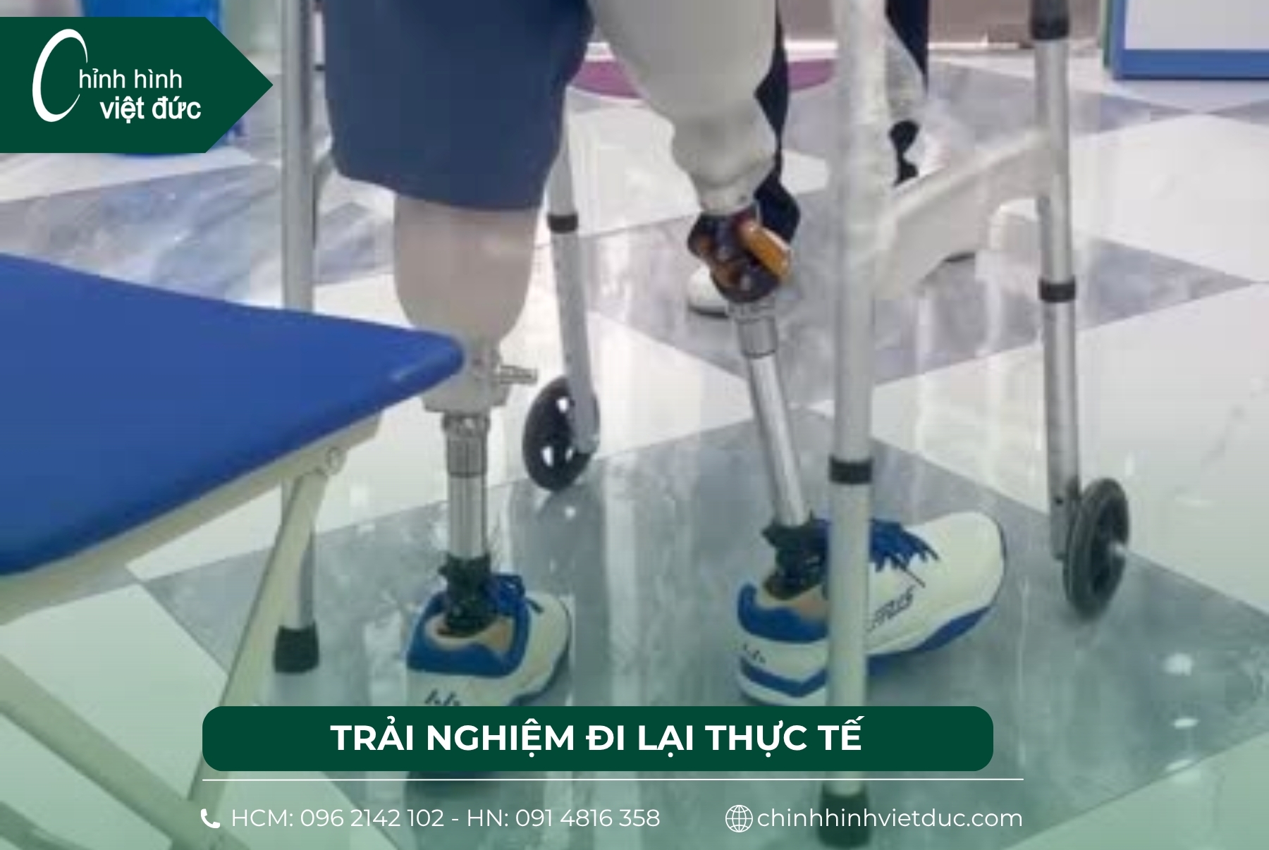 Mất 2 chân làm chân giả có đi được không?