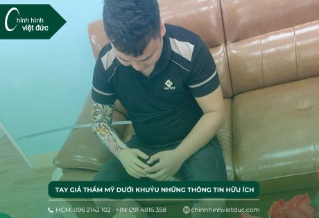 tay giả thẩm mỹ