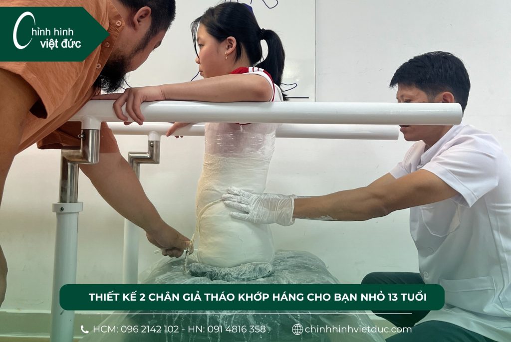 Thiết kế 2 chân giả tháo khớp háng cho bạn nhỏ 13 tuổi
