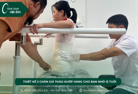 2 chân giả tháo khớp háng