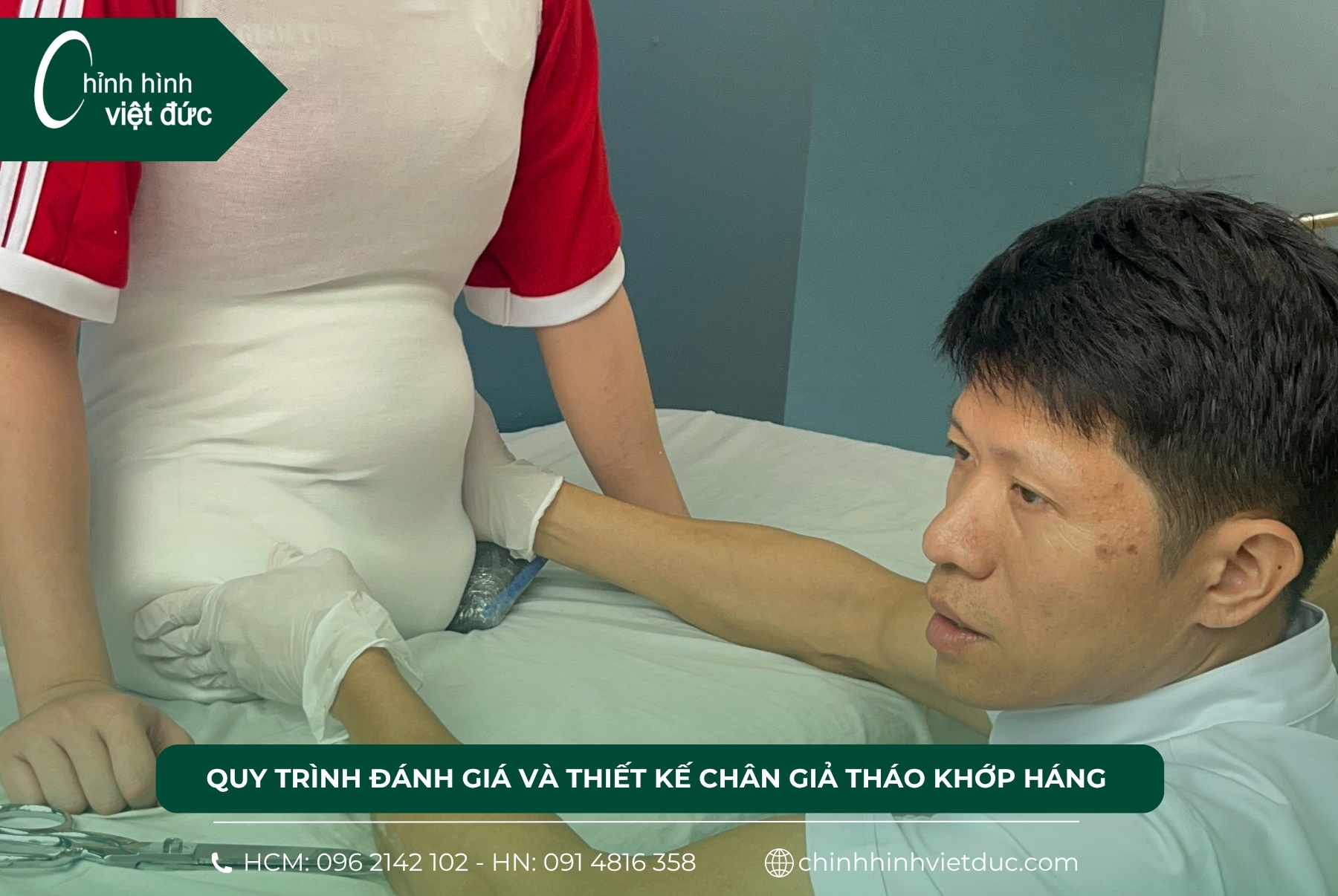 2 thiết kế chân giả tháo khớp háng 