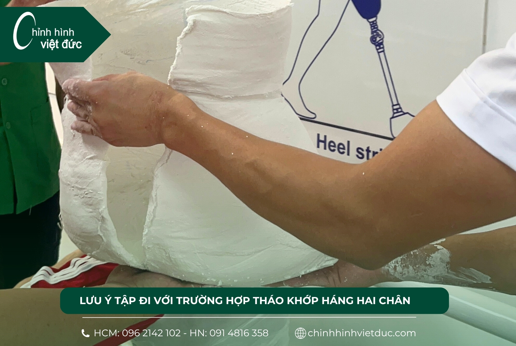2 chân tháo khớp háng 