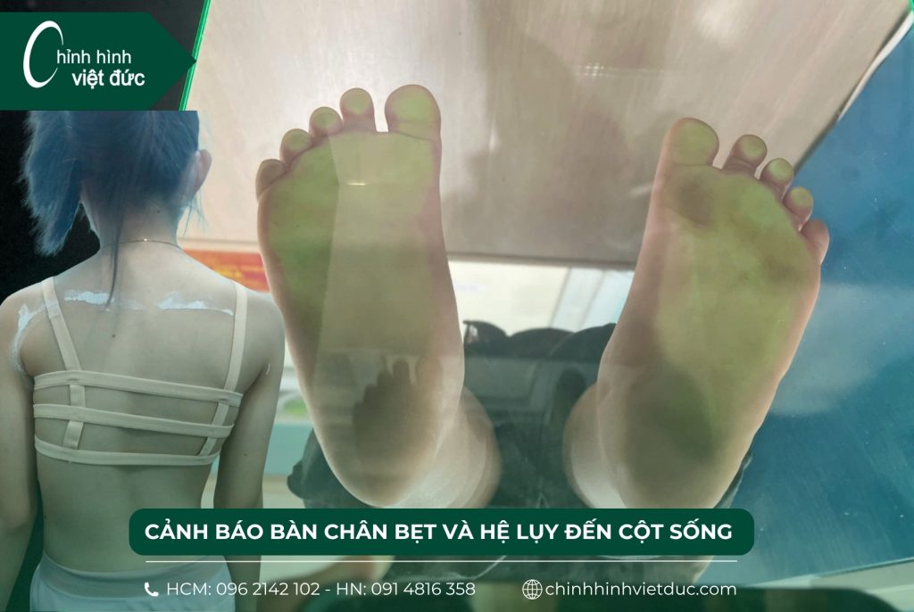 Cảnh báo bàn chân bẹt và hệ lụy đến cột sống