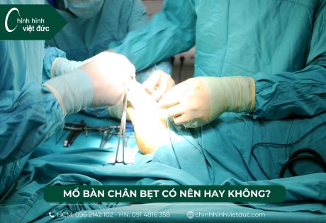 mổ bàn chân bẹt nên hay không