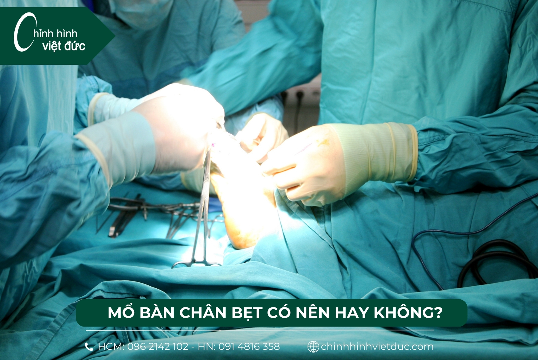 mổ bàn chân bẹt nên hay không