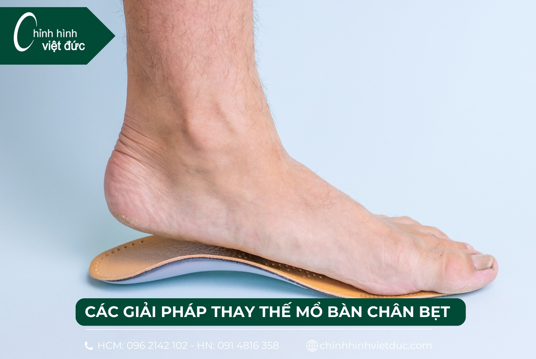 mổ bàn chân bẹt