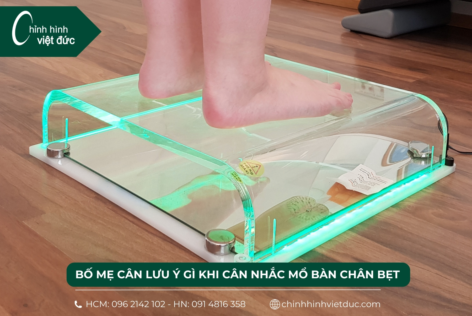 mổ bàn chân bẹt