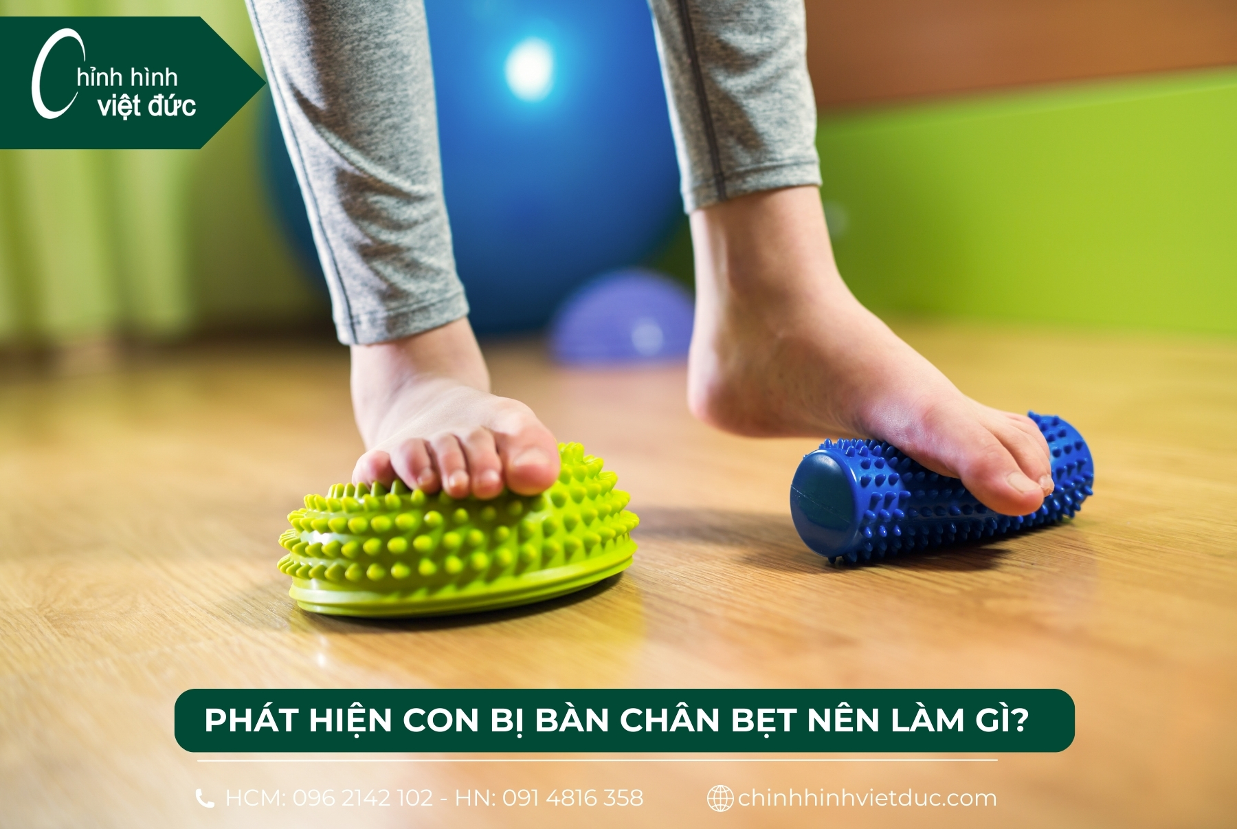 mổ bàn chân bẹt