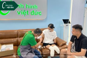 Thiết kế 2 tay giả điện tử cho bạn Nga Phú Thọ