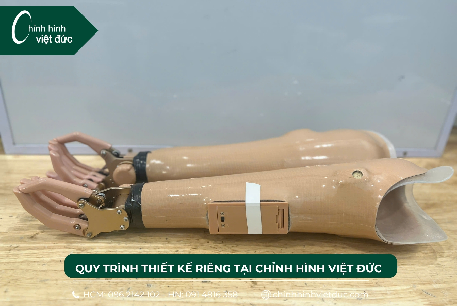 hai tay giả điện tử