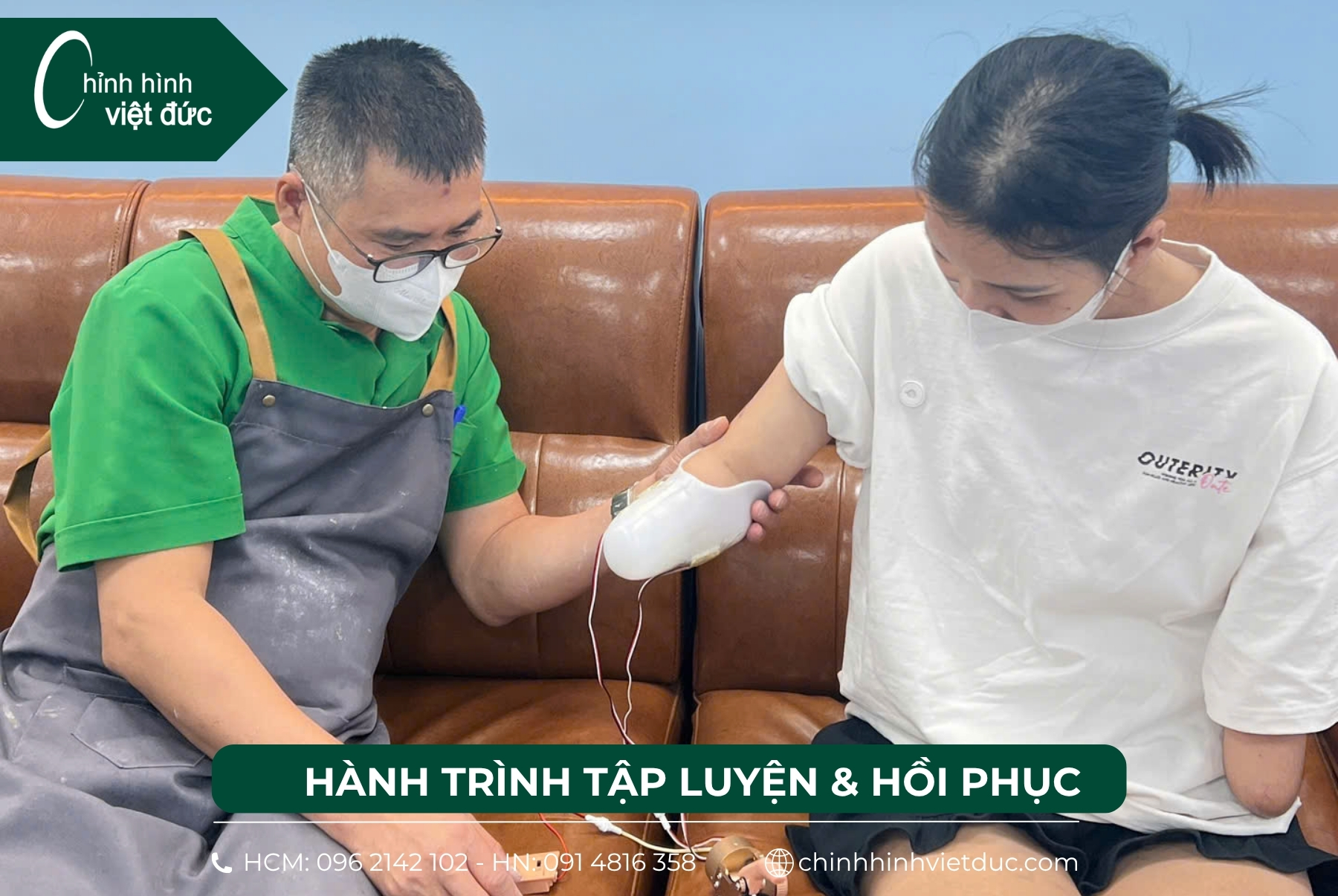 hai tay giả điện tử