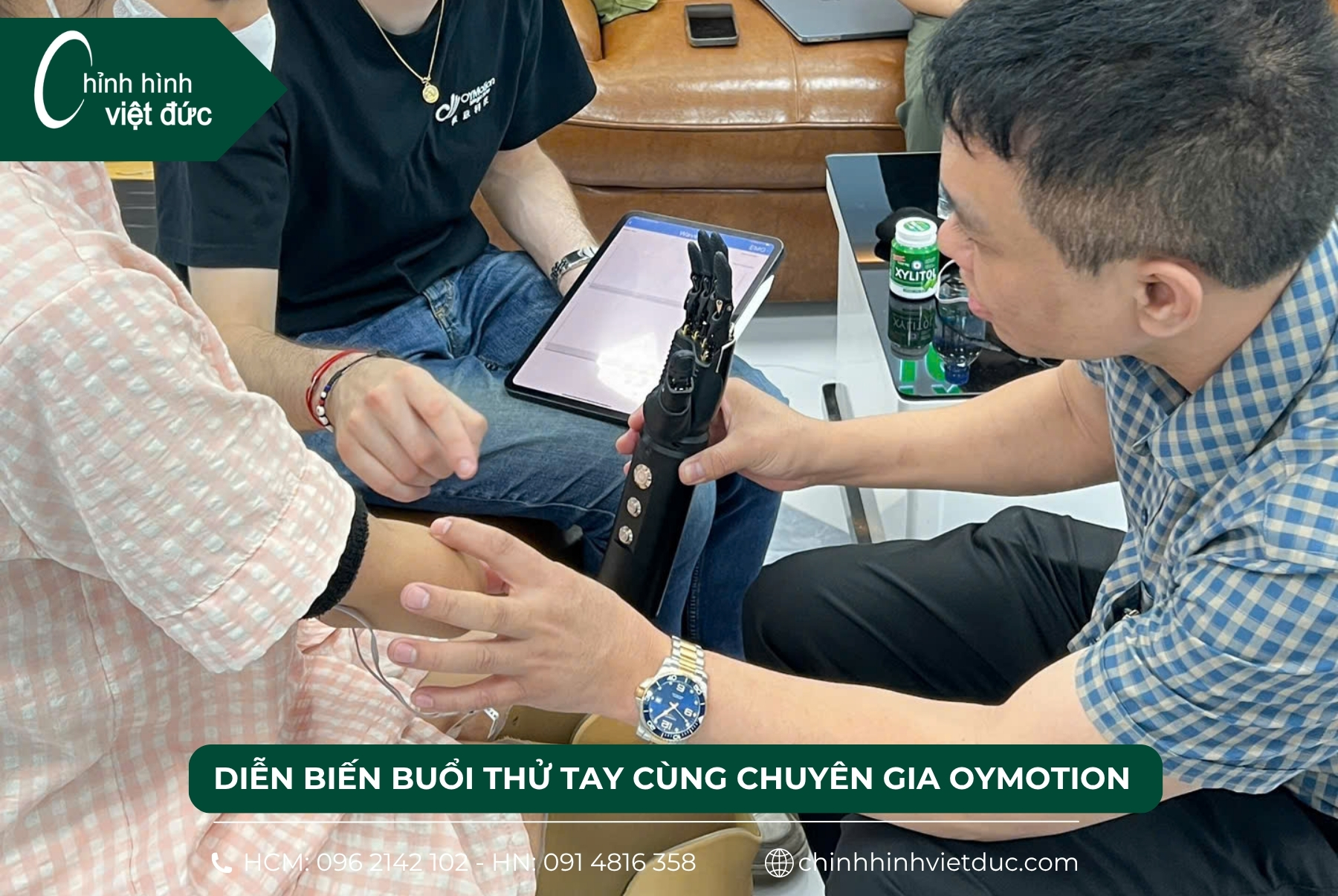 tay giả điện tử