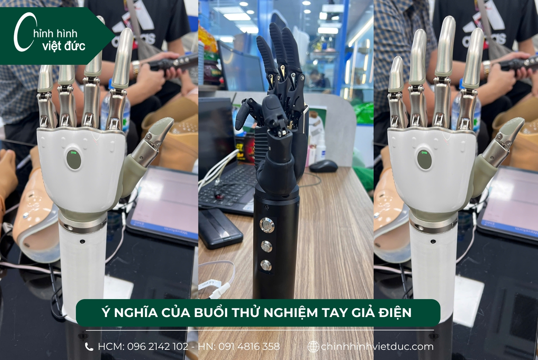 tay giả điện tử