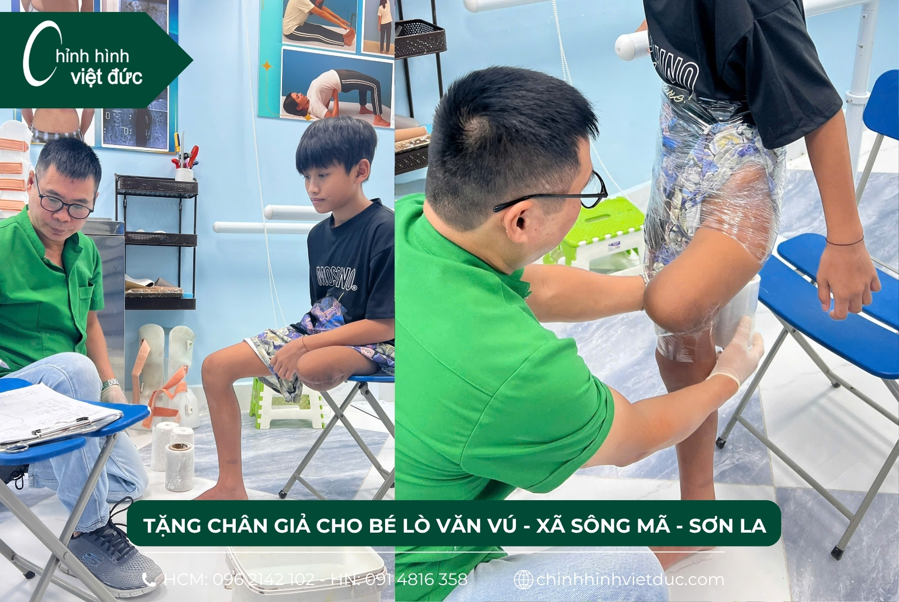 tặng chân giả