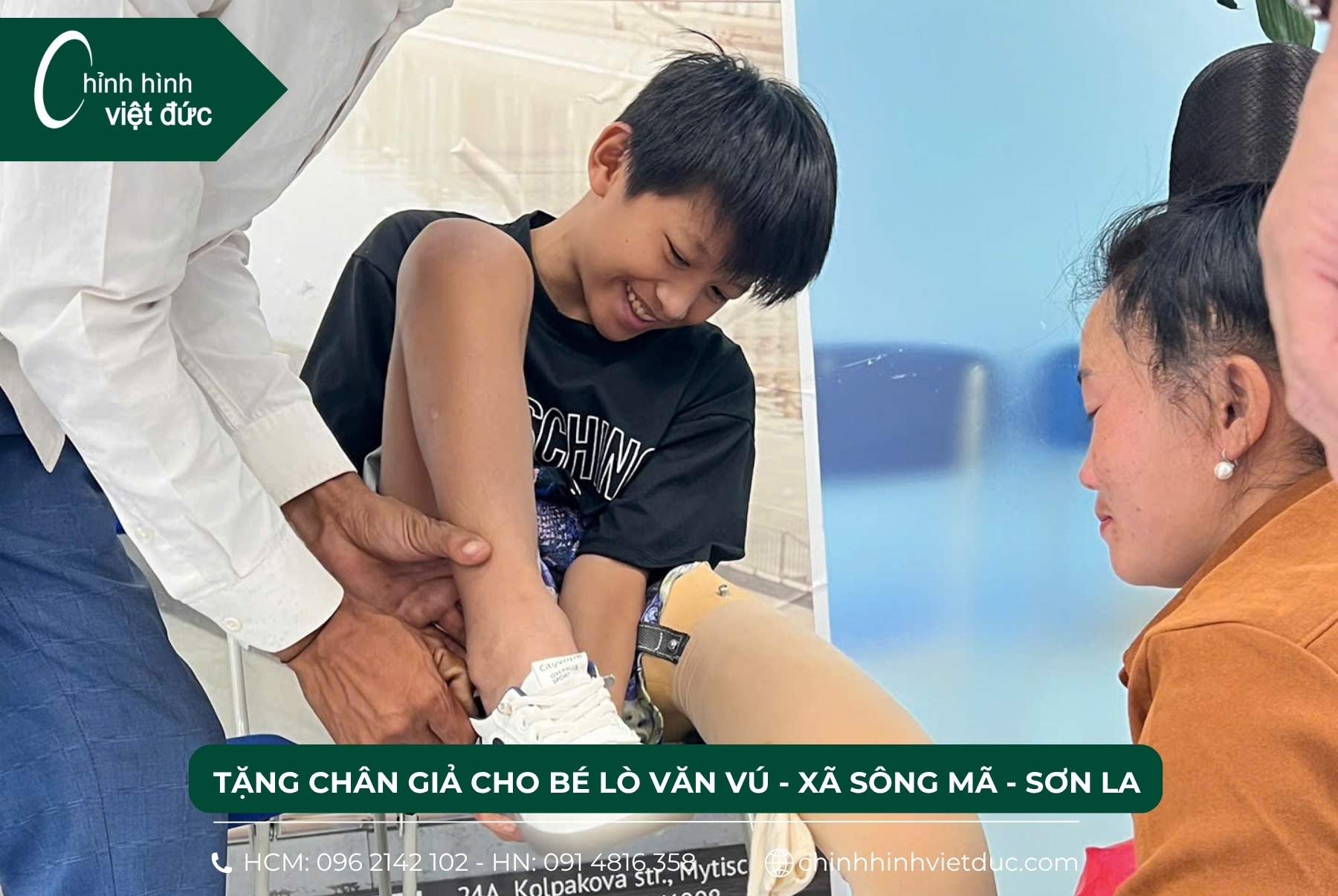 tặng chân giả 