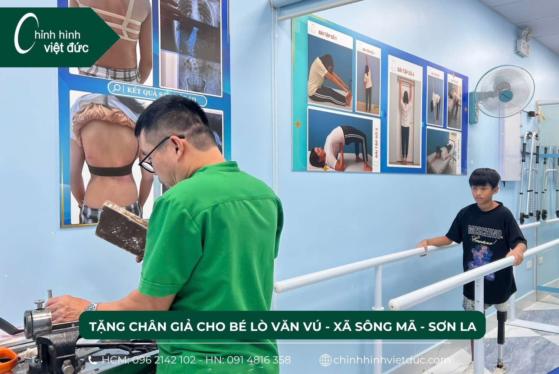 tặng chân giả