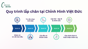 Quy trình lắp chân giả