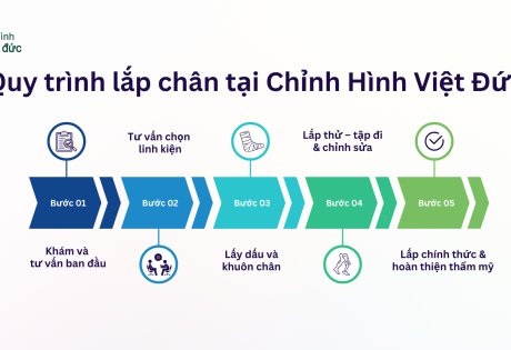 Quy trình lắp chân giả
