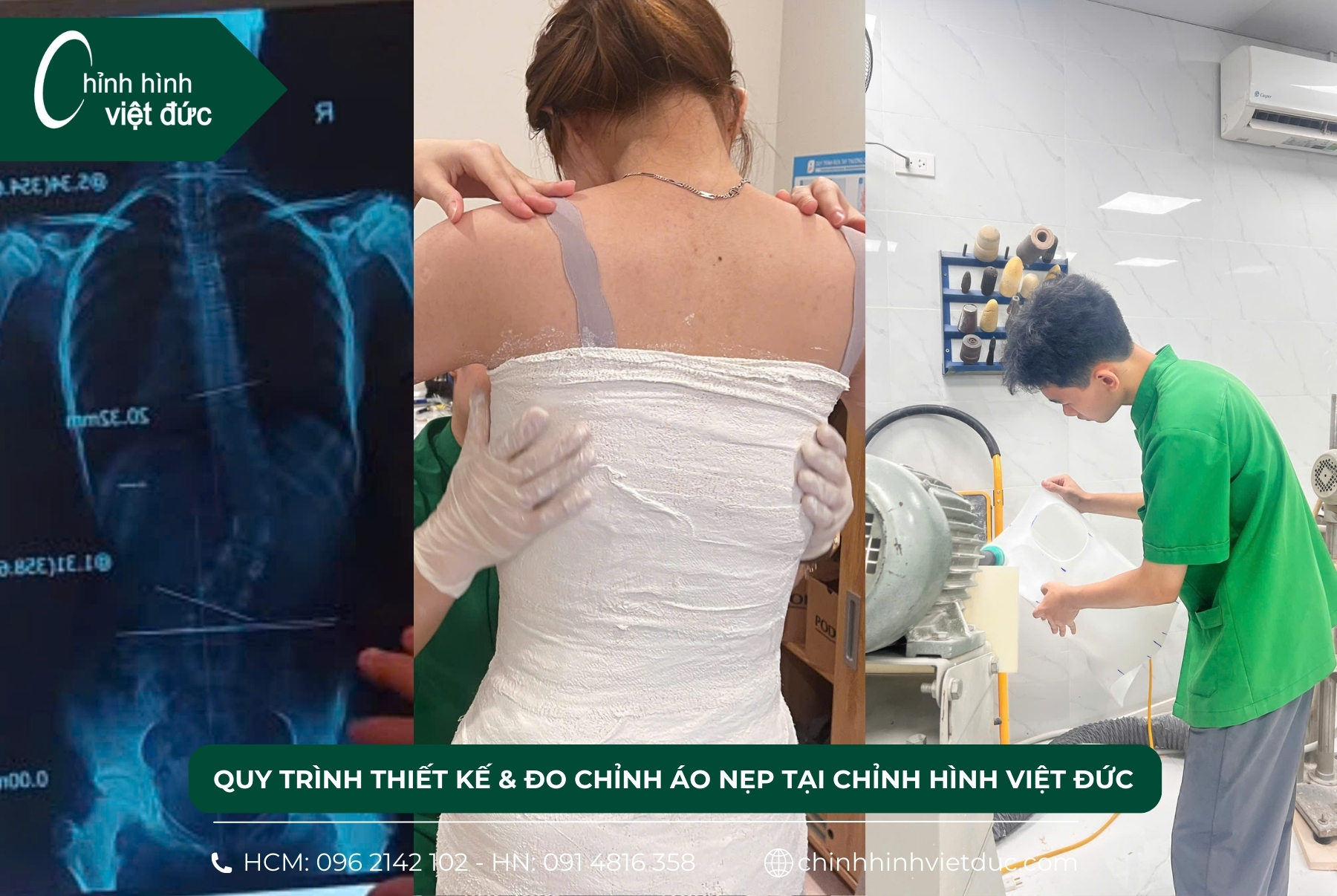 quy trình thiết kế và đo chỉnh áo nẹp