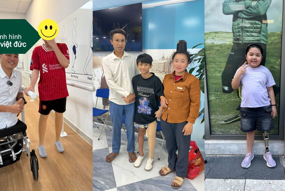 chân giả cho trẻ em