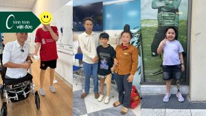 6 điều cần biết khi lựa chọn chân giả trẻ em