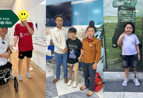 chân giả cho trẻ em