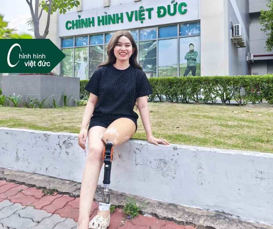 khách hàng Campuchia lắp chân tại Chỉnh Hình Việt Đức