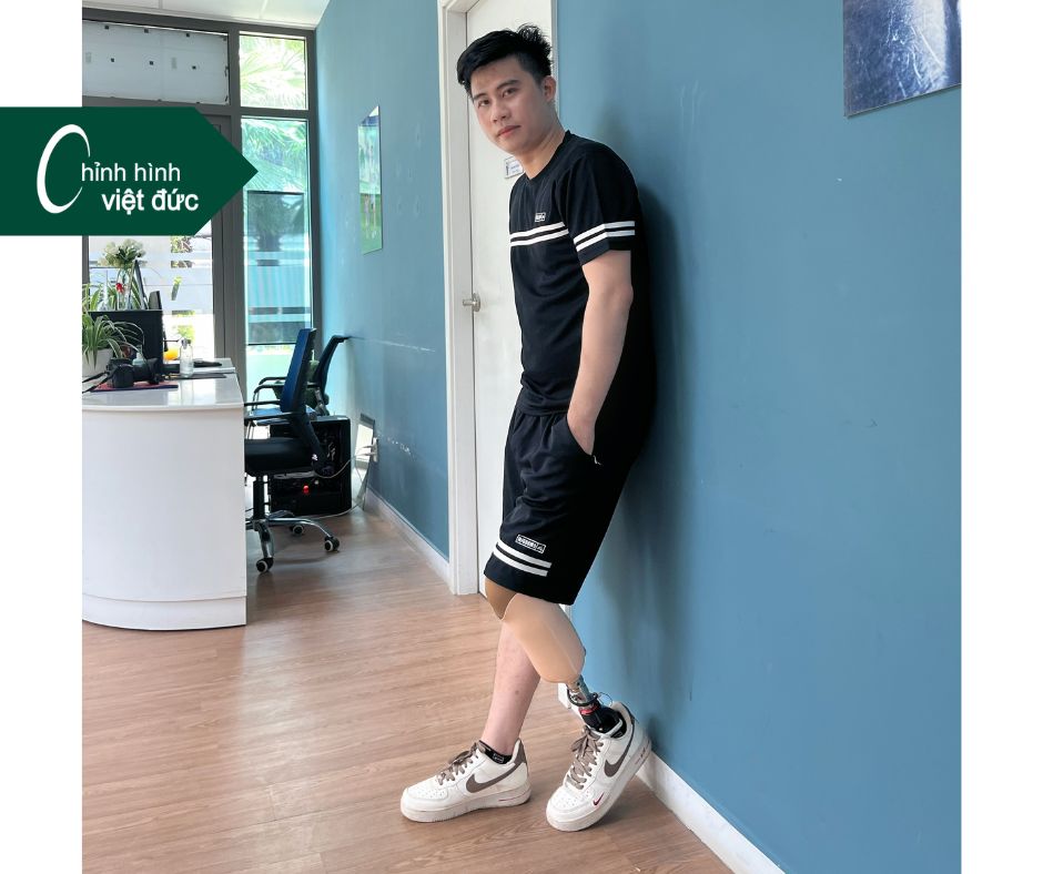 làm chân dưới gối có mắc không