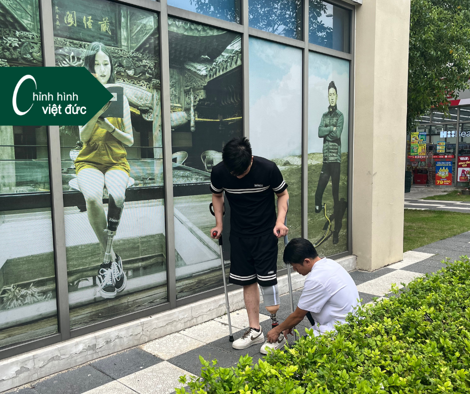 lắp chân giả ở Sài Gòn