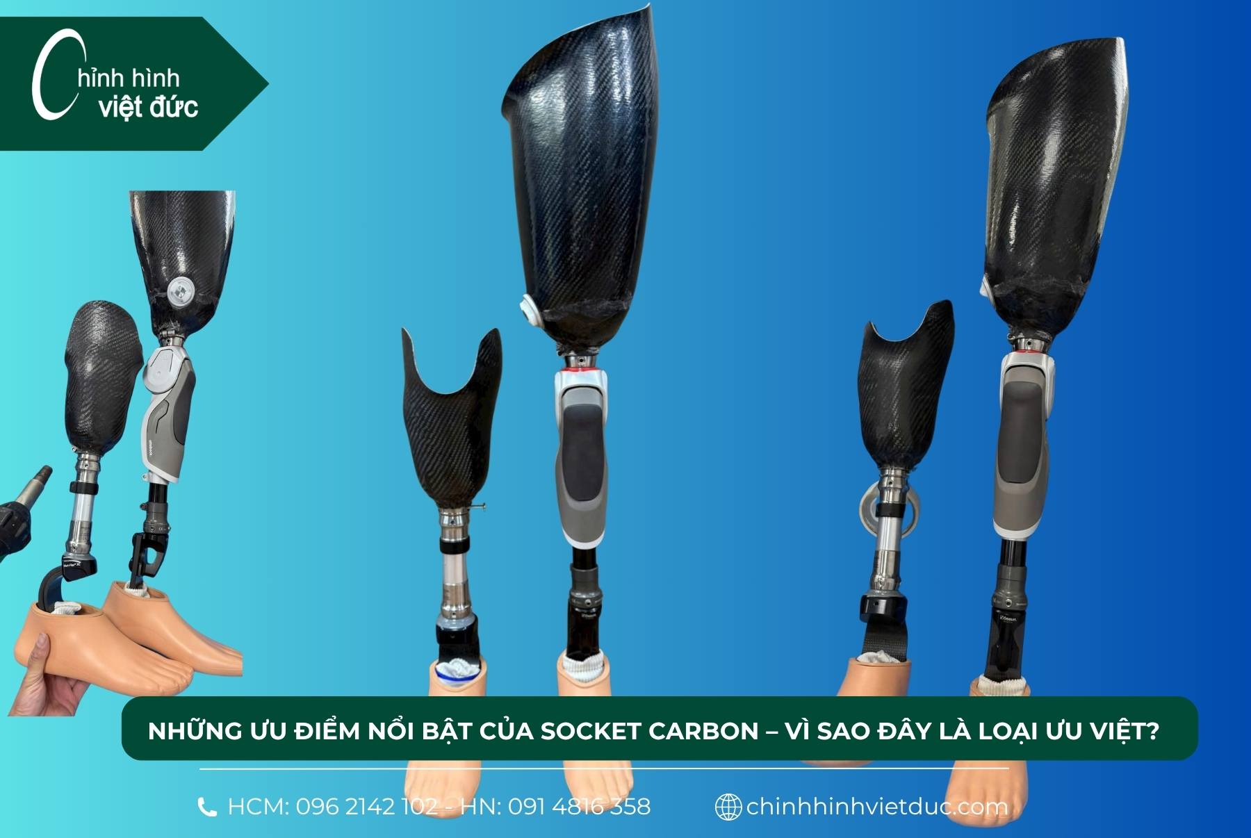 socket carbon chân trên gối