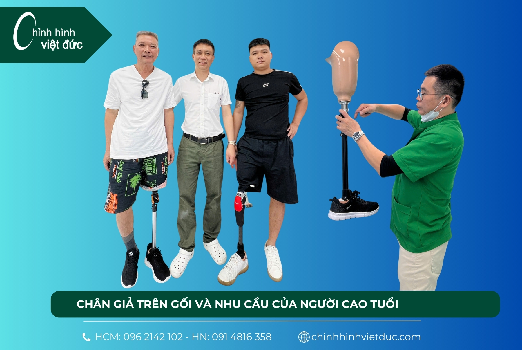 Vì sao nên chọn khớp Nga cho người già đi chân giả trên gối