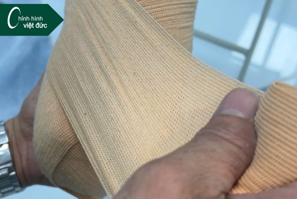 Tại sao cần cuốn băng chun cho mỏm cụt