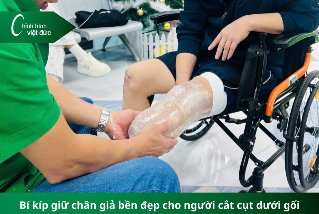 Bí kíp giữ chân giả bền đẹp cho từng loại cắt cụt