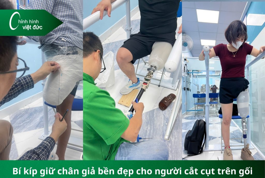 Bí kíp giữ chân giả bền đẹp cho từng loại cắt cụt