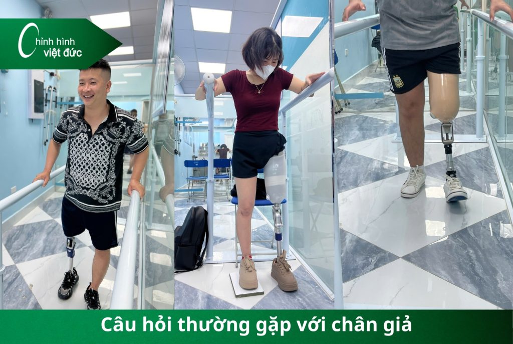 Bí kíp giữ chân giả bền đẹp cho từng loại cắt cụt