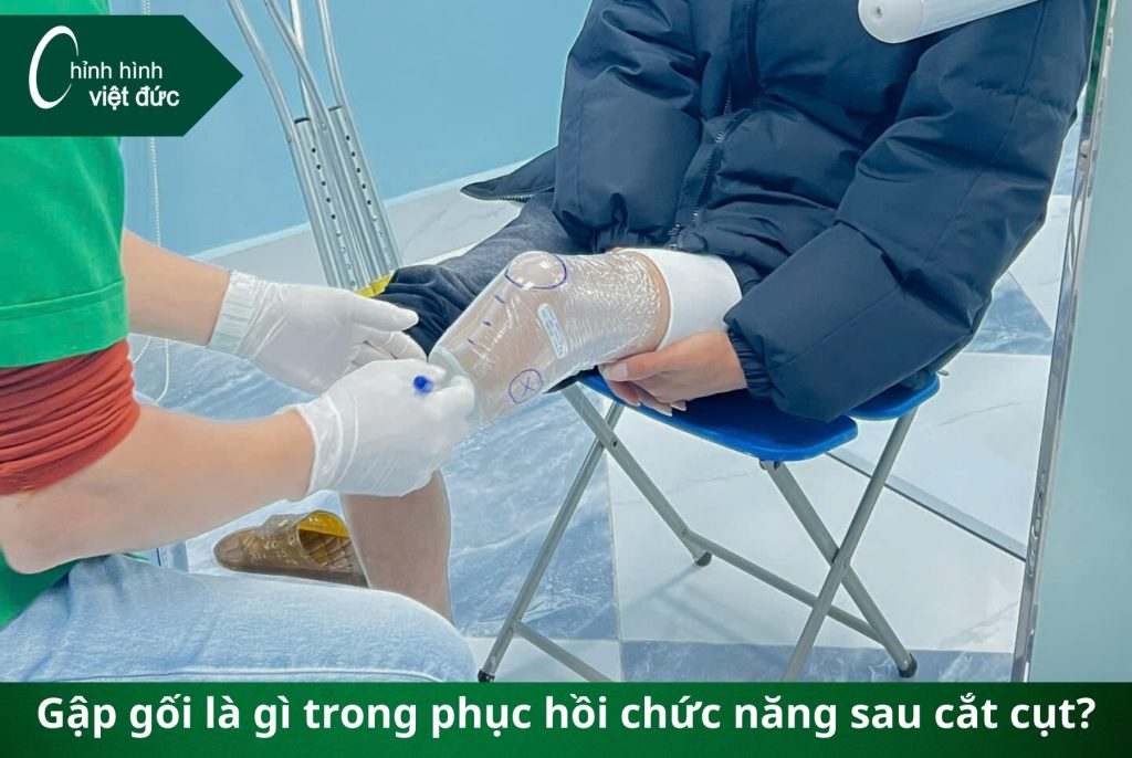 Tại sao tình trạng gập gối lại ảnh hưởng đến lắp chân giả